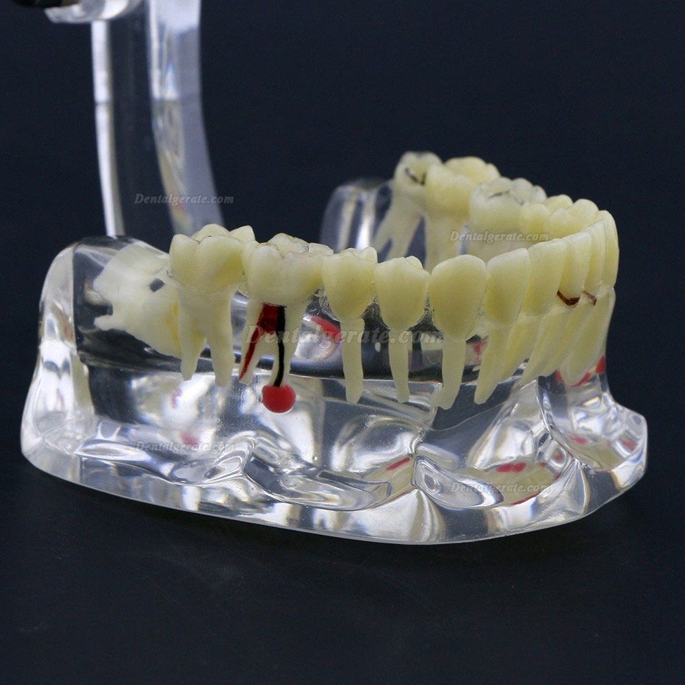 Neue Dental Teach-Studie Allgemeine Erwachsenenpathologie Typodont Z&auml;hne Modell # 4001